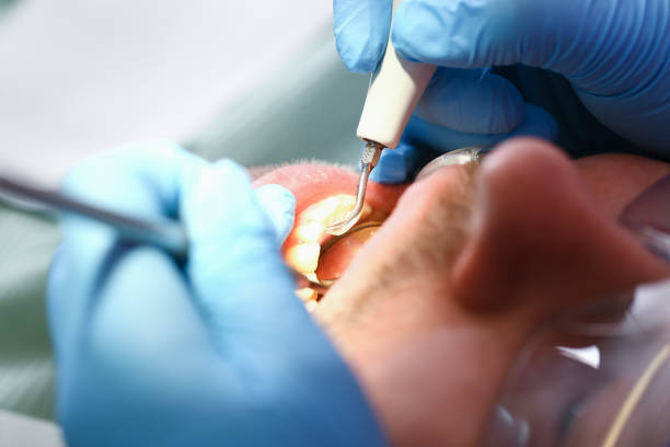 Best Emergency Treatment for Toothache in Lamoni, IA